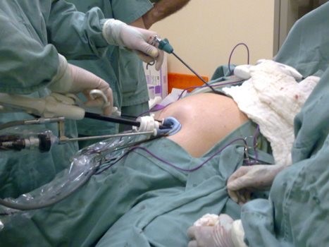 Imagem durante cirurgia bariátrica