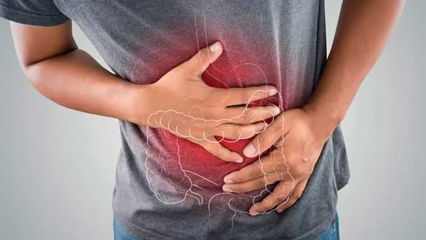 Nutricionista orienta sobre diverticulite