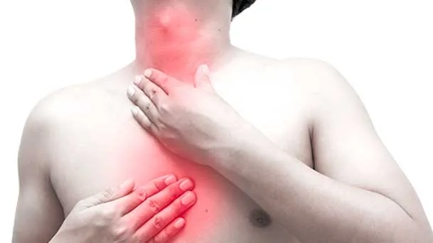 Orientações nutricionais para o Refluxo Gastro Esofágico (RGE)