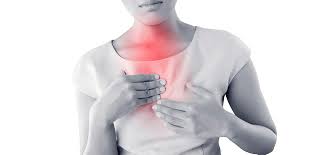 Orientações nutricionais para o Refluxo Gastro Esofágico (RGE)