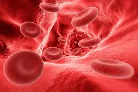 Anemia